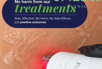 Can you 100% get Rid of Stretch Marks