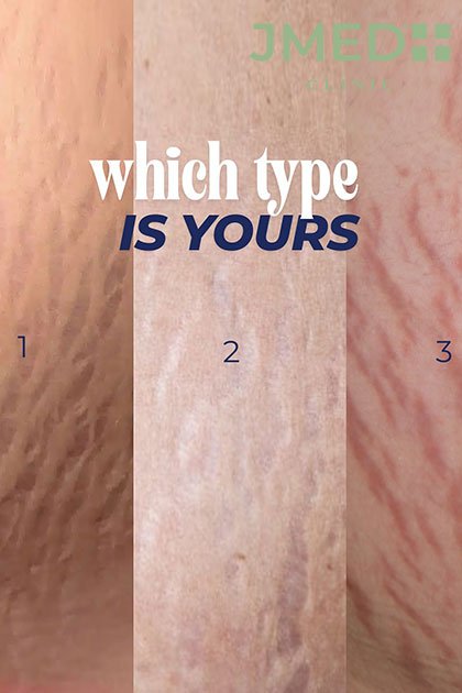 Choose the Right Aesthetic Clinic in Dubai