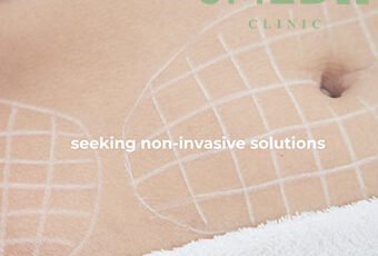 Does Scratching Cause Stretch Marks