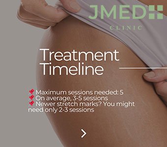 How Long Does It Take To Remove Stretch Marks