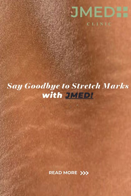 Inkless Camouflaging