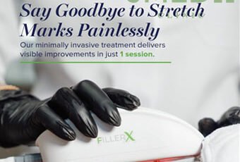 What is the Most Effective Stretch Mark Removal Treatment