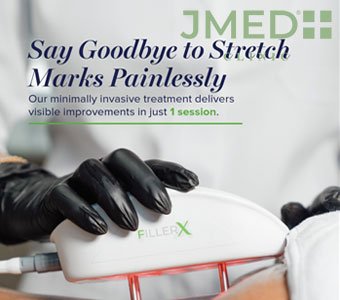 What is the Most Effective Stretch Mark Removal Treatment