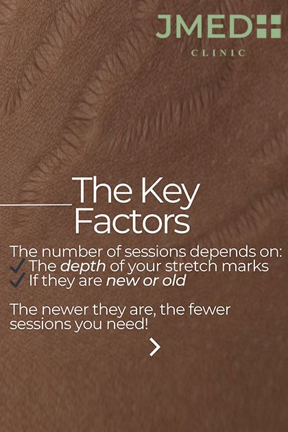 How JMED Stria Repair Works No Pain, No Downtime