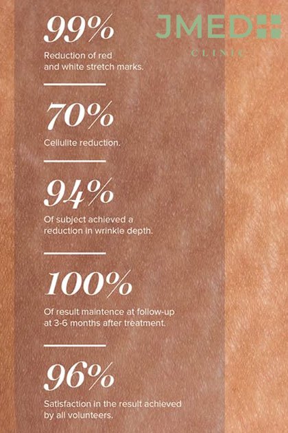 The JMED Stria Repair Method