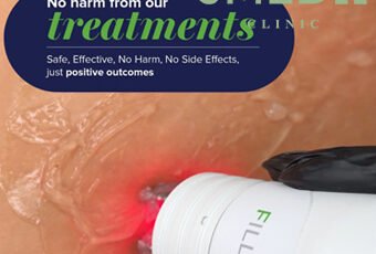 What's the most effective treatment for stretch marks