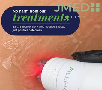 What's the most effective treatment for stretch marks