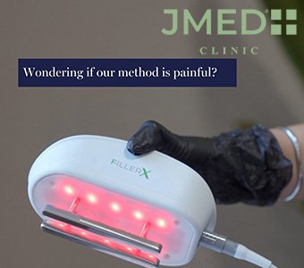 Can I remove my stretch marks permanently