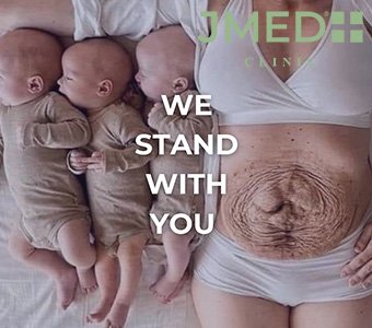 How to Prevent Stretch Marks During Pregnancy