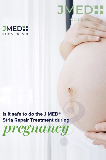 Prevent Stretch Marks During Pregnancy in Dubai