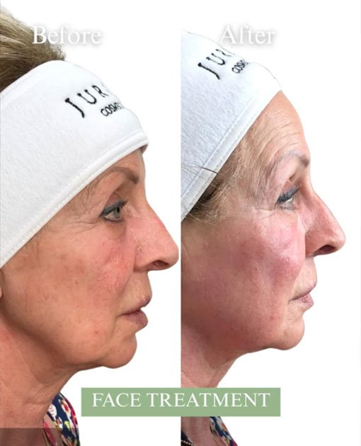 Best Aesthetic Clinic In Bluewaters Island