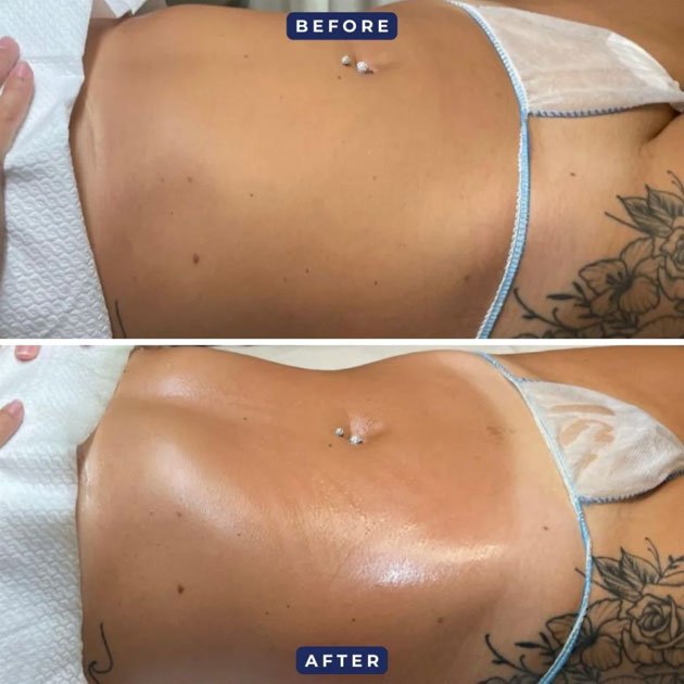 Best Skin Clinic In Emirates Hills