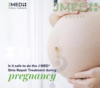 How to treat fresh stretch marks during pregnancy in Dubai