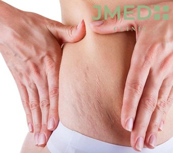 Plastic Surgery vs. Body Treatments