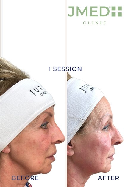 Post Plastic Surgery Recovery Treatments in Dubai