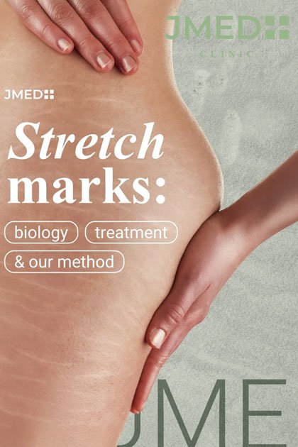 Old Deep Stretch Marks Removal in Dubai