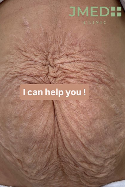 The Importance of Technical Accuracy in Skin Revision