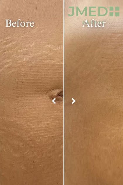 Specialised Solutions for Deeply Pigmented Skin